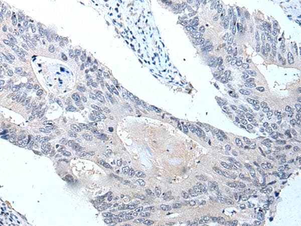 Polyclonal Rabbit anti-Human VPS35 Antibody (IHC, WB)