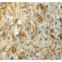 ZFP219 / ZNF219 Antibody