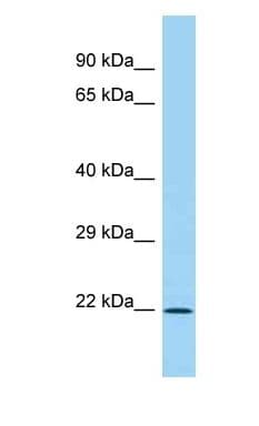 Polyclonal Rabbit anti-Human IL28B Antibody (C-Terminus, WB)