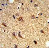 Polyclonal Rabbit anti-Human CNTNAP2 / CASPR2 Antibody (aa1079-1106, IHC, WB)