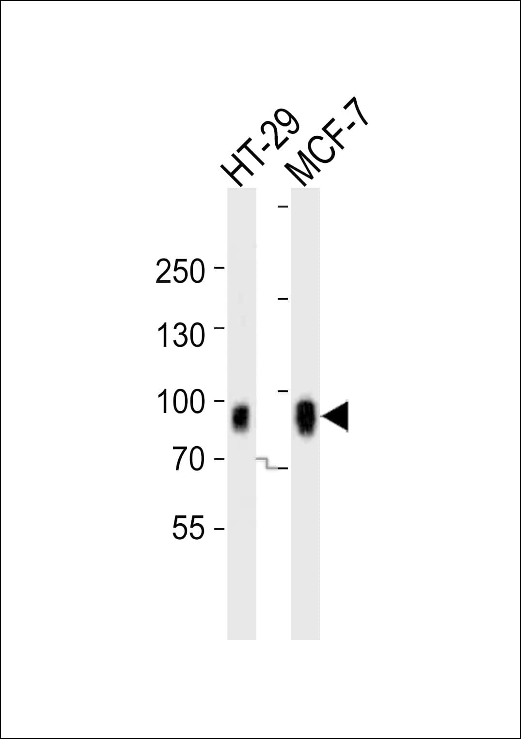 CAGE1 / Cancer Antigen 1 Antibody (aa2-35)