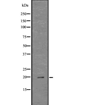 LL37 / Cathelicidin Antibody