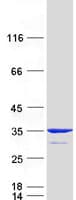 Human MITD1 Protein (Recombinant Myc-DDK (Flag))
