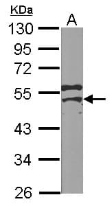 IHC-plus™ MSY2 / YBX2 Antibody (Internal)