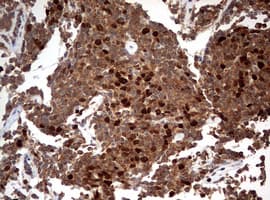 Monoclonal Mouse anti-Human TOP2A / Topoisomerase II Alpha Antibody (clone OTI2D12, aa1100-1531, IHC, WB)