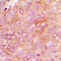 Polyclonal Rabbit anti-Human STMN1 / Stathmin / LAG Antibody (N-Terminus, IHC, IF, WB)