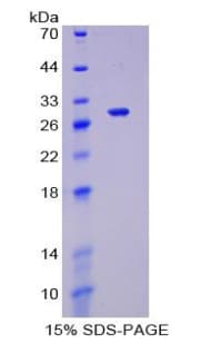 Mouse FOXP1 Protein (Recombinant His-T7)