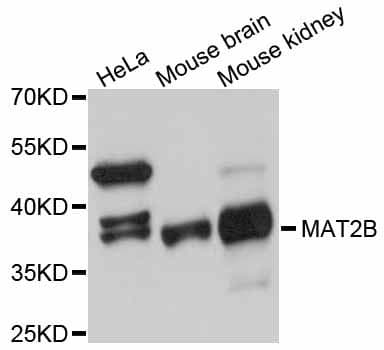 Polyclonal Rabbit anti-Human MAT2B Antibody (WB)