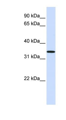 C16orf78 Antibody (aa108-157)