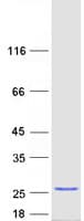 Human ANKRD39 Protein (Recombinant Myc-DDK (Flag))