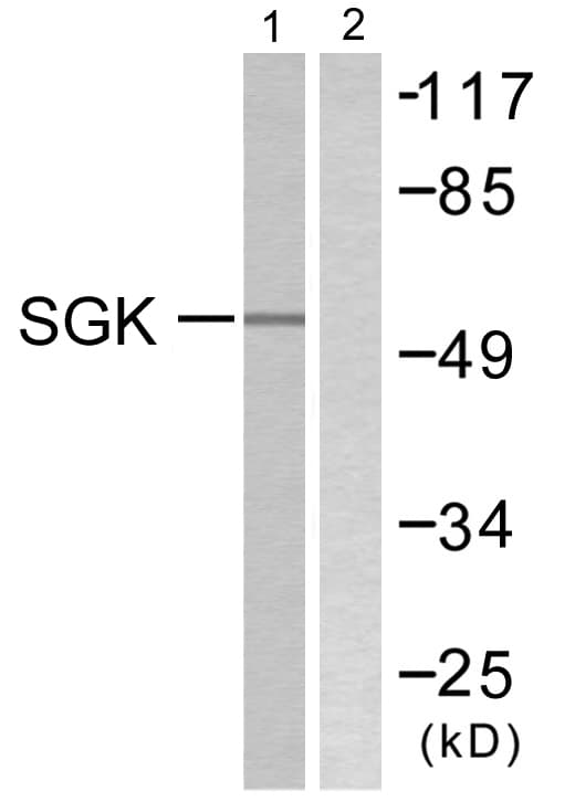 SGK1 / SGK Antibody (aa41-90)