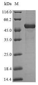 Human HAO2 Protein (Recombinant 6His-SUMO, N-terminus)