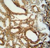 Polyclonal Rabbit anti-Human INSC Antibody (aa409-437, IHC, WB)