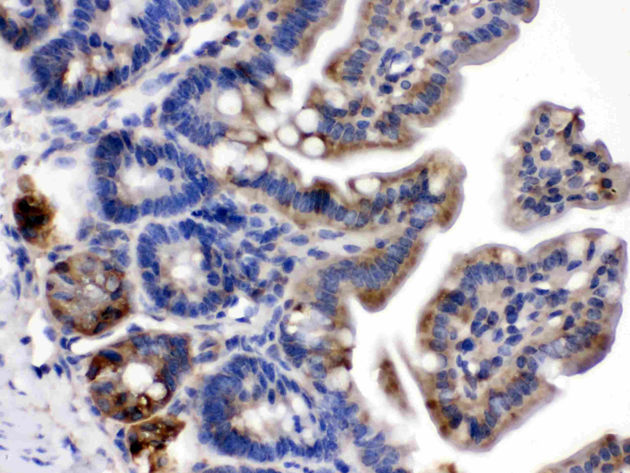 Polyclonal Rabbit anti-Human TLN2 / Talin 2 Antibody (IHC, WB)