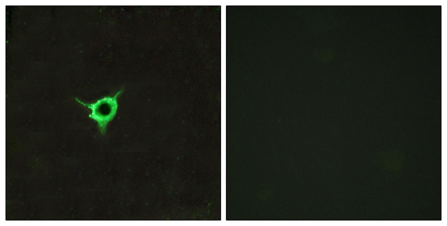 Polyclonal Rabbit anti-Human CNR1 / CB1 Antibody (IHC, IF, WB)