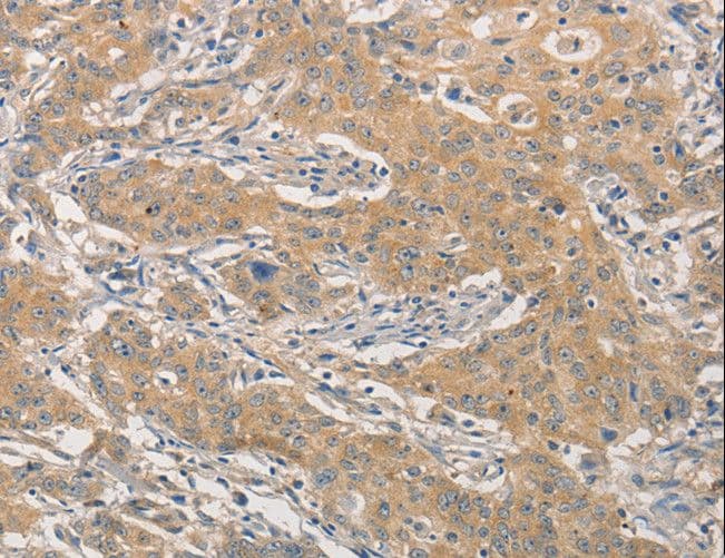 TCF11 / NFE2L1 Antibody
