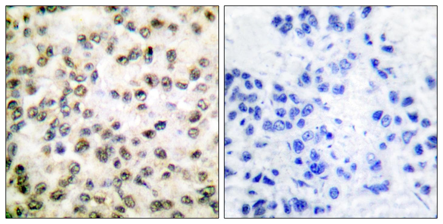 CREBBP / CREB Binding Protein Antibody