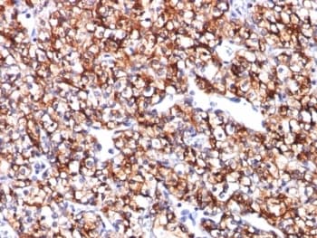 CA9 / Carbonic Anhydrase IX Antibody (clone CA9/781)