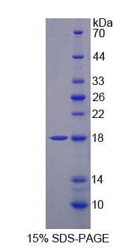 Mouse TNFRSF17 / BCMA Protein (Recombinant His)