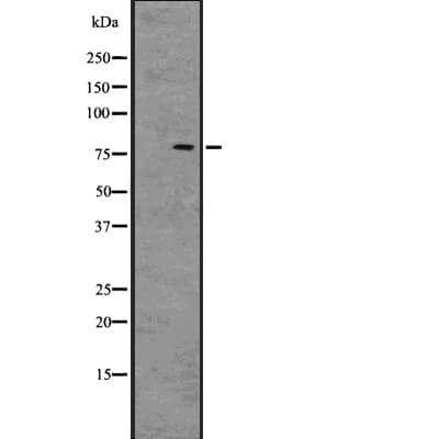 BCL6 Antibody