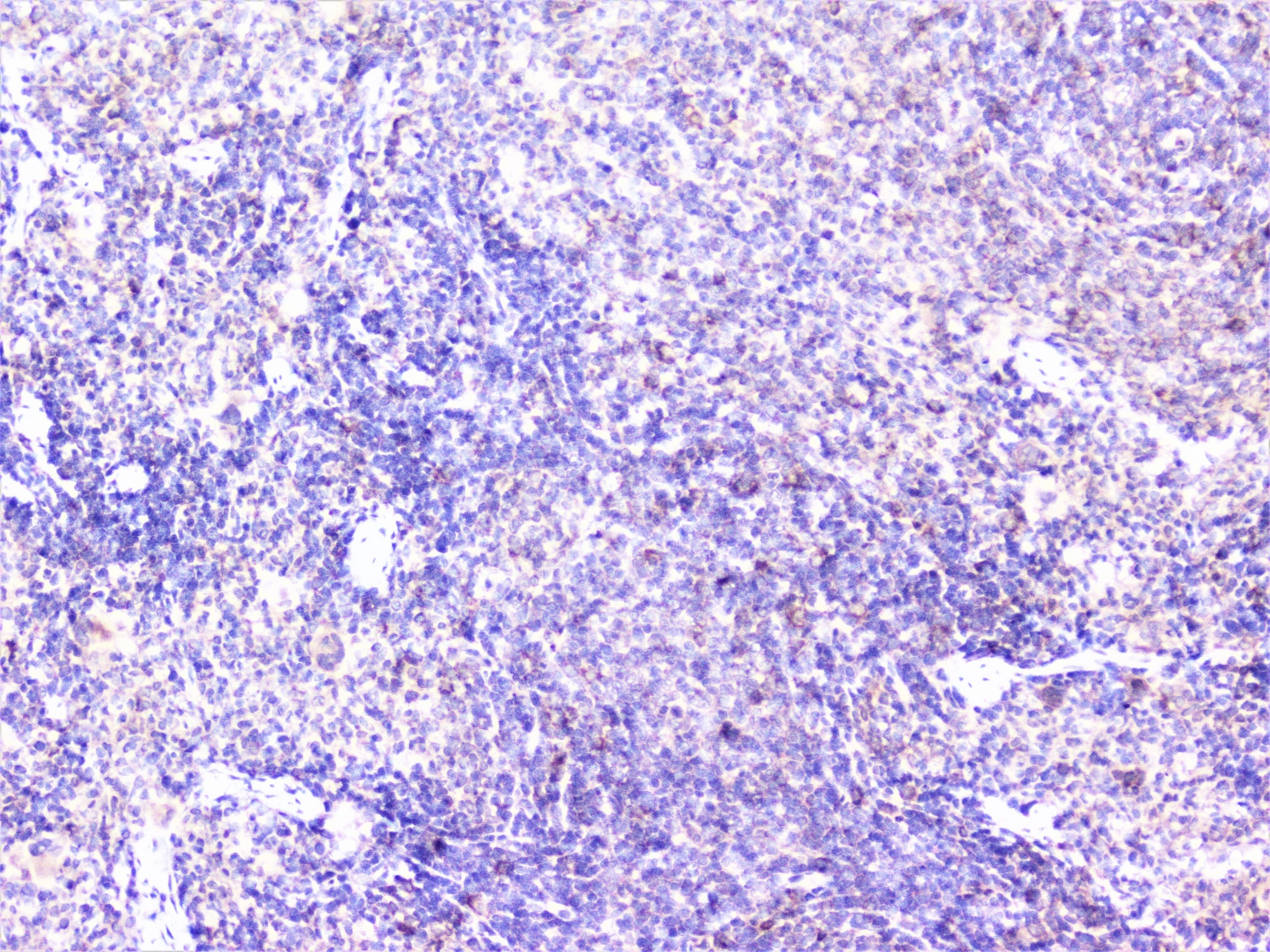 CTTN / Cortactin Antibody