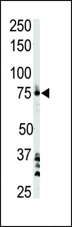 Polyclonal Rabbit anti-Human BTK Antibody (aa209-239, IHC, IF, WB)