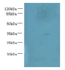 NUBPL Antibody