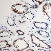 Polyclonal Rabbit anti-Human ARRDC2 Antibody (Internal, IHC, WB)