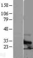 TM4SF6 / TSPAN6 Protein (Over-Expression Lysate Myc-DDK (Flag))