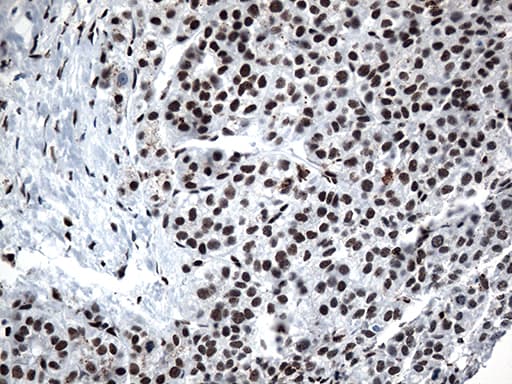GTF3C4 Antibody (aa583-822, clone OTI4A1)