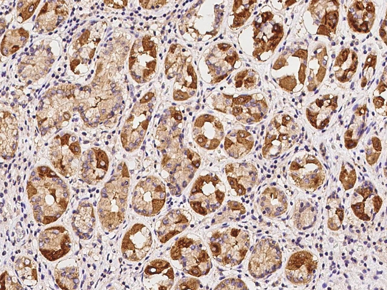 Polyclonal Rabbit anti-Human KCNQ1 / KVLQT1 Antibody (IHC)