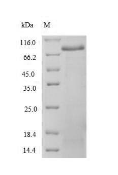 Human SSNA1 Protein (Recombinant GST, N-terminus)