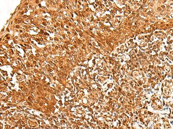 ADRM1 Antibody