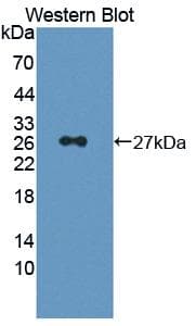 Polyclonal Rabbit anti-Human Prostaglandin D Synthase Antibody (aa1-199, WB)