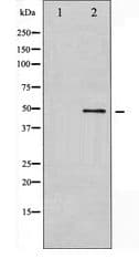 Polyclonal Rabbit anti-Human GSK3A / GSK3 Alpha Antibody (IHC, WB)