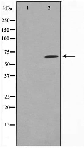 PAK3 Antibody (phospho-Ser154)
