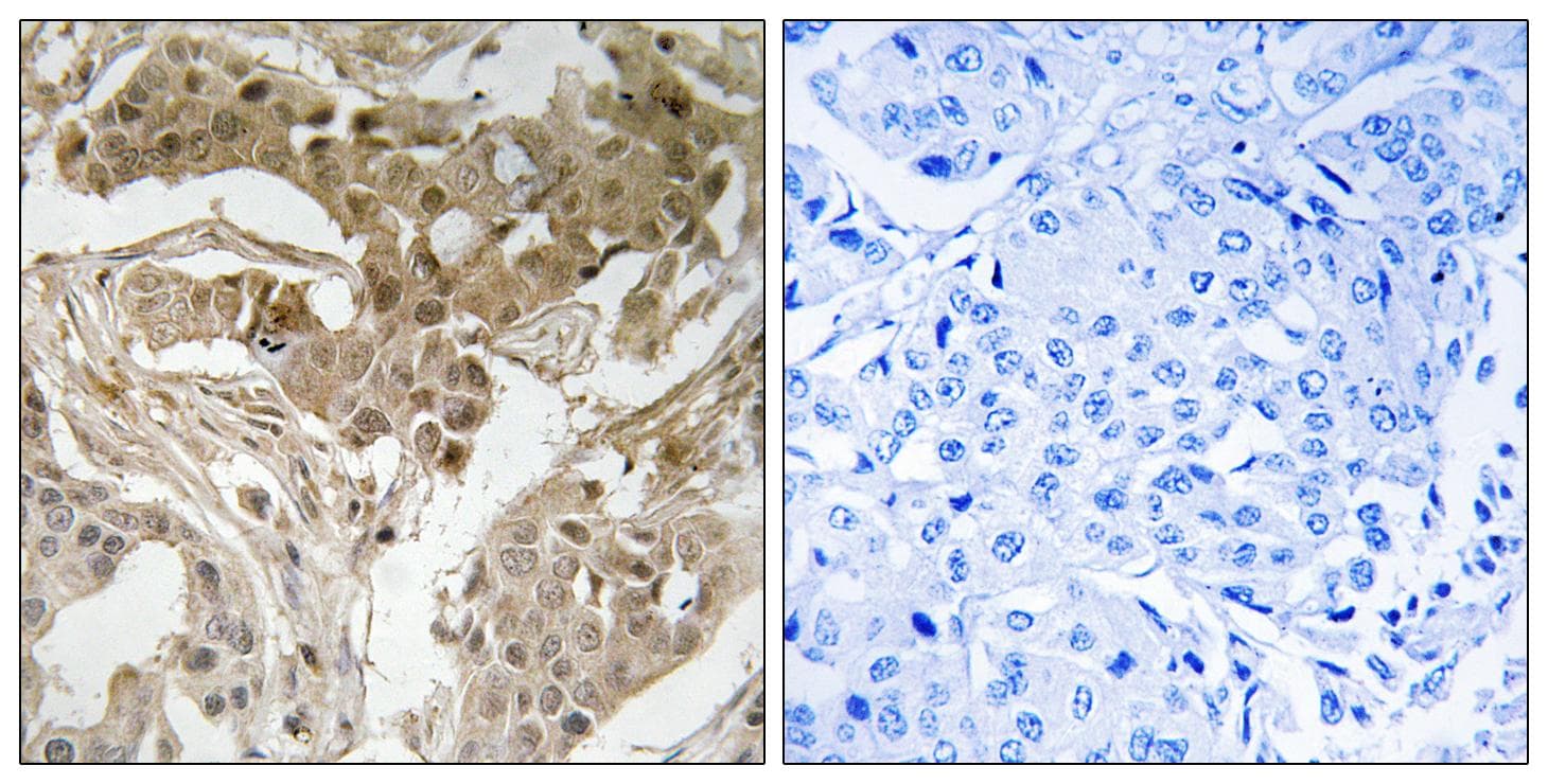 FOS / c-FOS Antibody (phospho-Thr232)