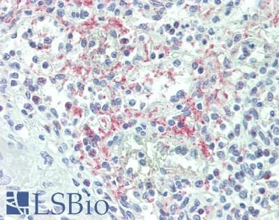 IHC-plus™ ZFPM1 / FOG1 Antibody (aa175-225)