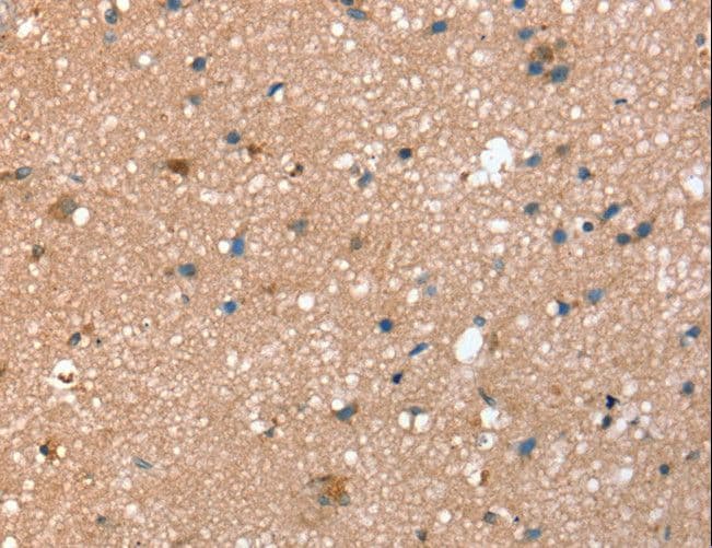 Polyclonal Rabbit anti-Human STX2 / Syntaxin 2 Antibody (IHC, WB)