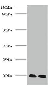 IHC-plus™ PARK7 / DJ-1 Antibody (aa 1-188)