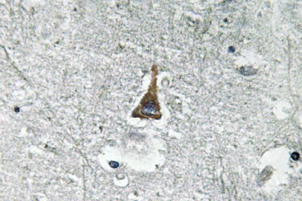 ADM / Adrenomedullin Antibody (Asn100)