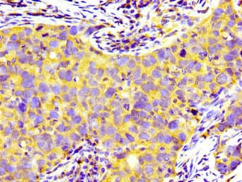 PRNP / PrP / Prion Antibody