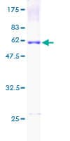 Human UCP2 Protein (Recombinant GST)