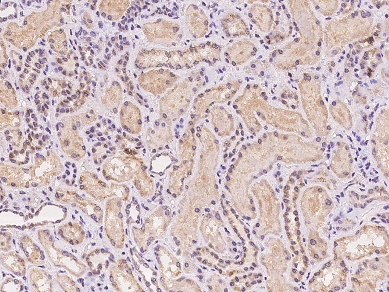 Polyclonal Rabbit anti-Human MRPL42 / MRPS32 Antibody (IHC)