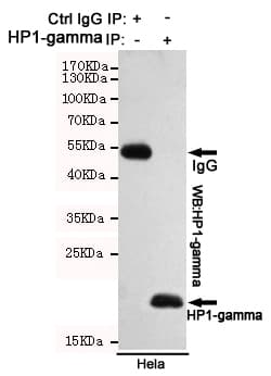 PathPlus™ Monoclonal Mouse anti-Human CBX3 / HP1 Gamma Antibody (IHC, WB)