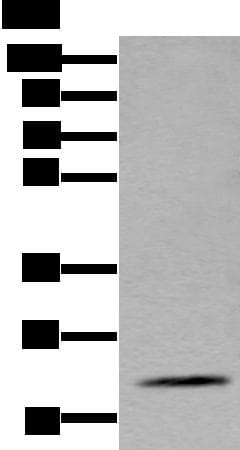 ZFAND5 Antibody