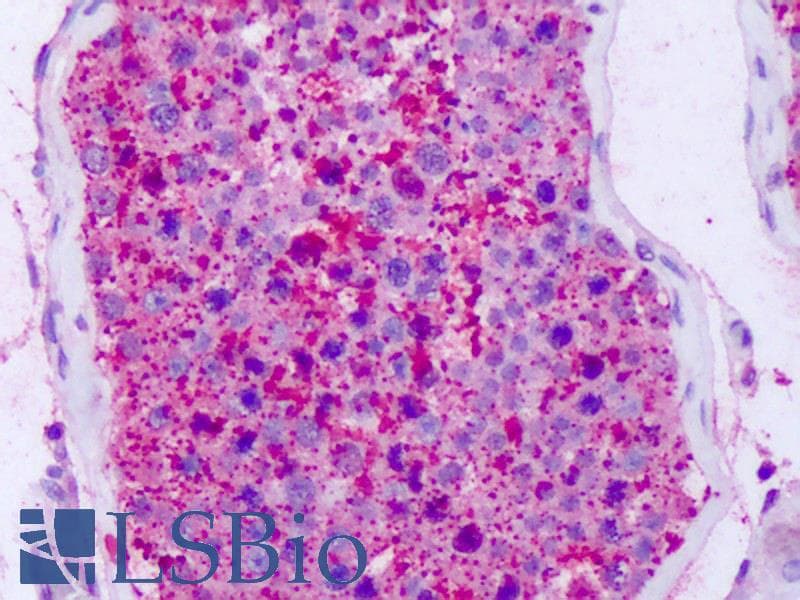 IHC-plus™ Polyclonal Rabbit anti-Human NPFF2 / NPFFR2 Antibody (C-Terminus, IHC)
