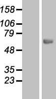 Carboxylesterase 5A / CES5A Protein (Over-Expression Lysate Myc-DDK (Flag))