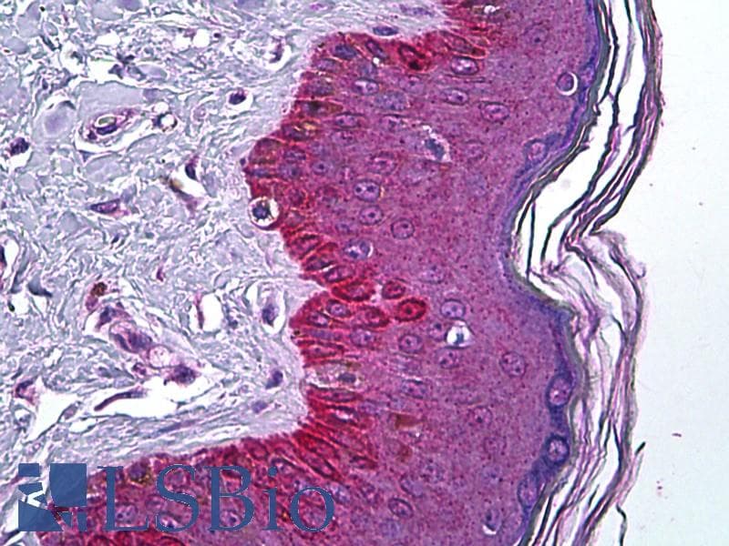 IHC-plus™ PNPLA3 / Adiponutrin Antibody (aa186-197)