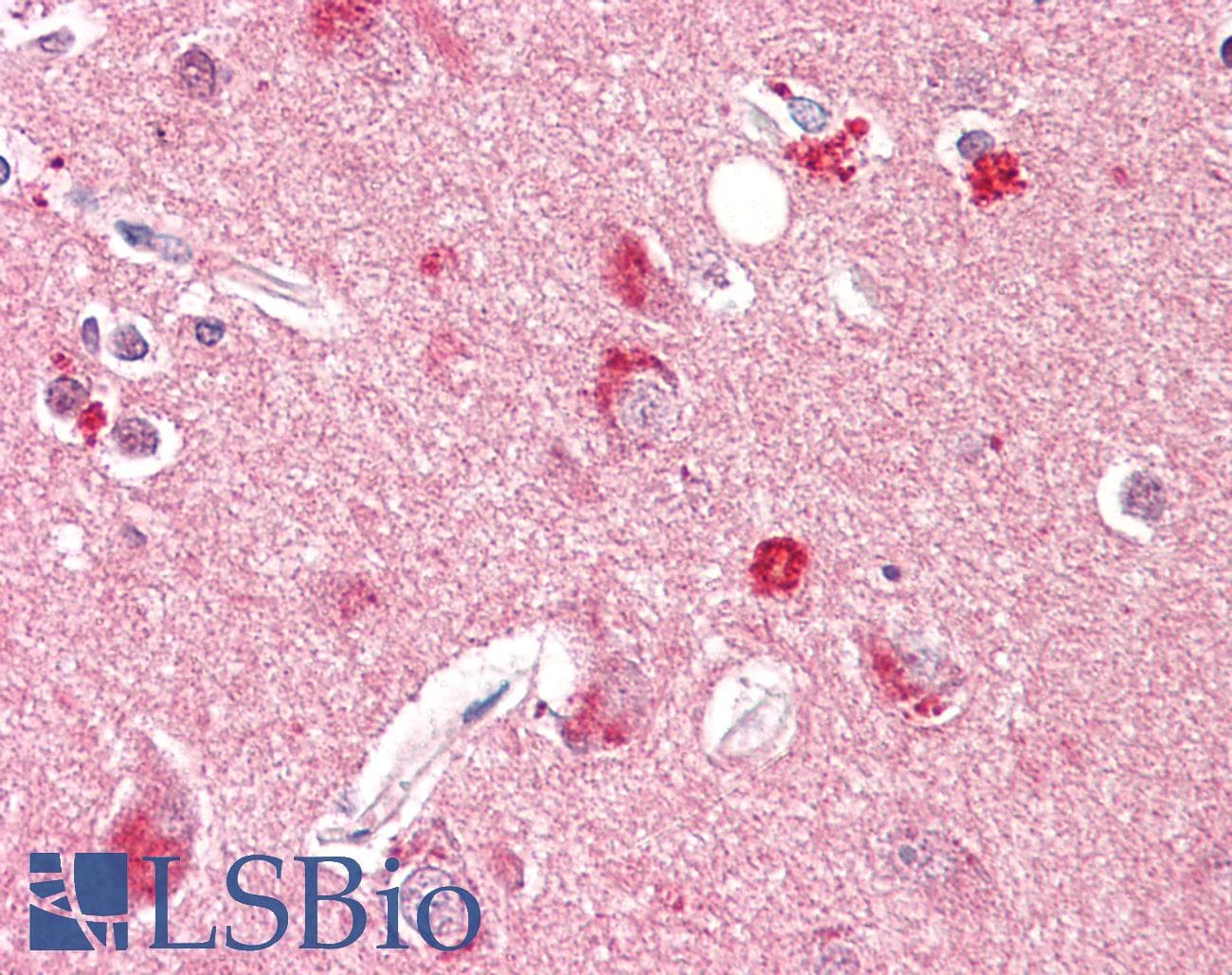 IHC-plus™ SNCA / Alpha-Synuclein Antibody (aa91-140)